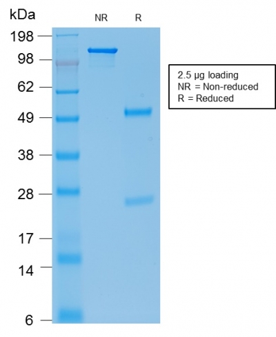 Data from SDS-PAGE analysis of Anti-E-Cadherin antibody (Clone rCDH1/1525). Reducing lane (R) shows heavy and light chain fragments. NR lane shows intact antibody with expected MW of approximately 150 kDa. The data are consistent with a high purity, intact mAb.